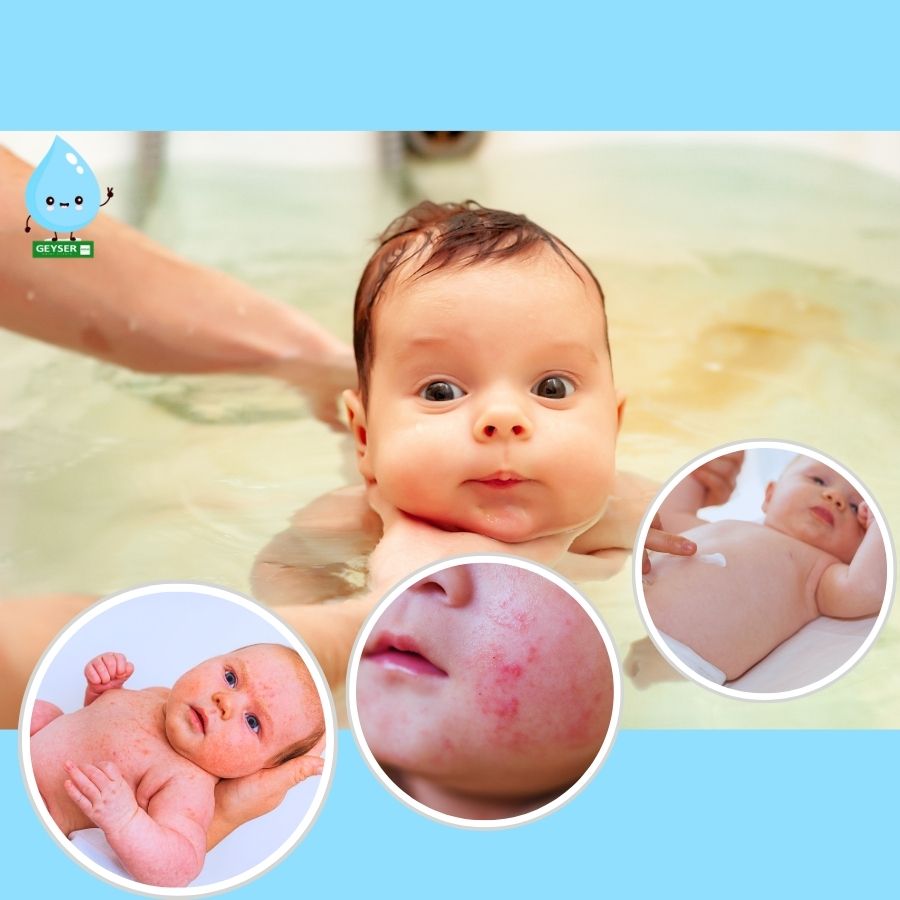 Tác hại khi tắm bé bằng nước máy chứa clo