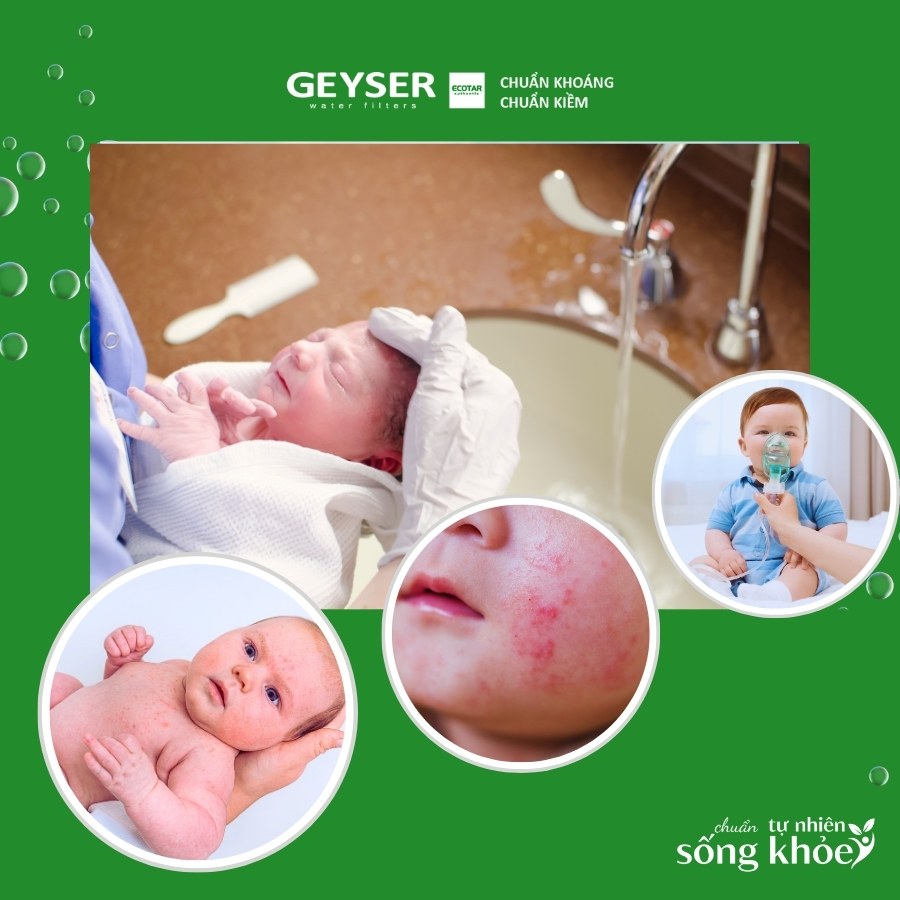 Tác hại khi tắm bé bằng nước máy chứa clo